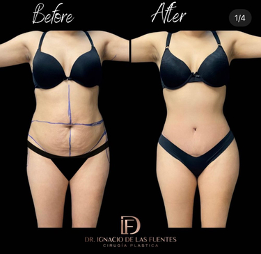 Slider image (9) Dr. Ignacio De Las Fuentes